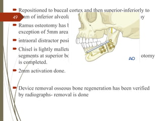 49
 Repositioned to buccal cortex and then superior-inferiorly to
3mm of inferior alveolar canal and then lingual osteotomy
 Ramus osteotomy has been completely sectioned with
exception of 5mm area of bone medial to IAN
 intraoral distractor positioned in place
 Chisel is lightly malleted between proximal and distal
segments at superior border, manually rotating it till osteotomy
is completed.
 2mm activation done.
 Device removal osseous bone regeneration has been verified
by radiographs- removal is done
 