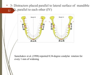 57
• 3- Distractors placed parallel to lateral surface of mandible
(III), parallel to each other (IV)
Samchukov et al. (1998) reported 0.34-degree condylar rotation for
every 1 mm of widening
 