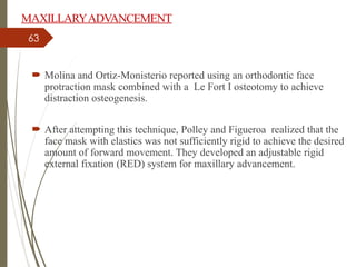 63
 Molina and Ortiz-Monisterio reported using an orthodontic face
protraction mask combined with a Le Fort I osteotomy to achieve
distraction osteogenesis.
 After attempting this technique, Polley and Figueroa realized that the
face mask with elastics was not sufficiently rigid to achieve the desired
amount of forward movement. They developed an adjustable rigid
external fixation (RED) system for maxillary advancement.
MAXILLARYADVANCEMENT
 