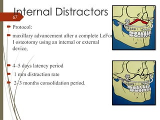 67
Internal Distractors
 Protocol:
 maxillary advancement after a complete LeFort
I osteotomy using an internal or external
device,
 4–5 days latency period
 1 mm distraction rate
 2–3 months consolidation period.
 