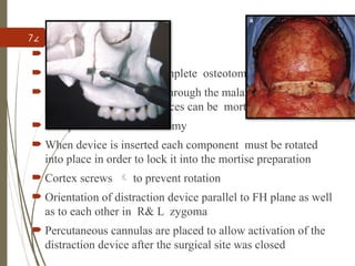 72
 Surgical technique
 Bicoronal flap
 Trans oral exposure to complete osteotomy
 The vertical osteotomies through the malar bones are
positioned so that the devices can be mortised into place
 Complete lefort III osteotomy
 When device is inserted each component must be rotated
into place in order to lock it into the mortise preparation
 Cortex screws  to prevent rotation
 Orientation of distraction device parallel to FH plane as well
as to each other in R& L zygoma
 Percutaneous cannulas are placed to allow activation of the
distraction device after the surgical site was closed
 