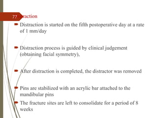 77
Distraction
 Distraction is started on the fifth postoperative day at a rate
of 1 mm/day
 Distraction process is guided by clinical judgement
(obtaining facial symmetry),
 After distraction is completed, the distractor was removed
 Pins are stabilized with an acrylic bar attached to the
mandibular pins
 The fracture sites are left to consolidate for a period of 8
weeks
 