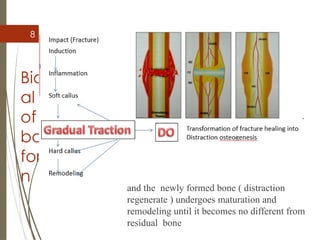 8
Biologic
al basis
of new
bone
formatio
n
 After callus has formed traction force is
applied to these bone segments  which
gradually pushes them apart
 Gradual incremental separation of bone
segments places the callus under tensional
stress  aligns the newly formed inter-
segmentory tissue parallel to the direction of
traction
 After desired amount of lengthening is
achieved the distraction force is discontinued
and the newly formed bone ( distraction
regenerate ) undergoes maturation and
remodeling until it becomes no different from
residual bone
 