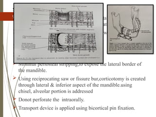95
SURGICAL
 Osteotomy is placed 1.5 cm from the distal edge of the bone
adjacent to the discontinuity defect,tocreate a transport disc.
 This disc is advanced through the defect with bone
regenerated in the distraction gap.
 A 3 point fixation device is often placed.
 Extraoral submandibular approach.
 Minimal periosteal stripping,to expose the lateral border of
the mandible.
 Using reciprocating saw or fissure bur,corticotomy is created
through lateral & inferior aspect of the mandible.using
chisel, alveolar portion is addressed
 Donot perforate the intraorally.
 Transport device is applied using bicortical pin fixation.
 