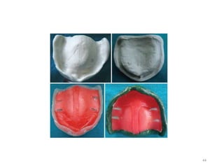 management of abused tissues | PPTX