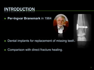 Osseointegration part 1 | PPTX