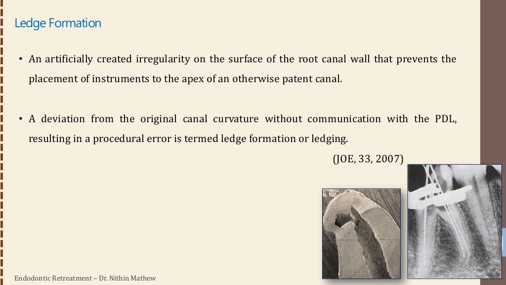 Endodontic Retreatment