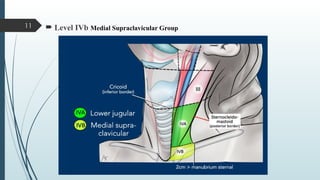 Layered Neck Level Seminar 1 Delineation of the neck node levels for head.pptx