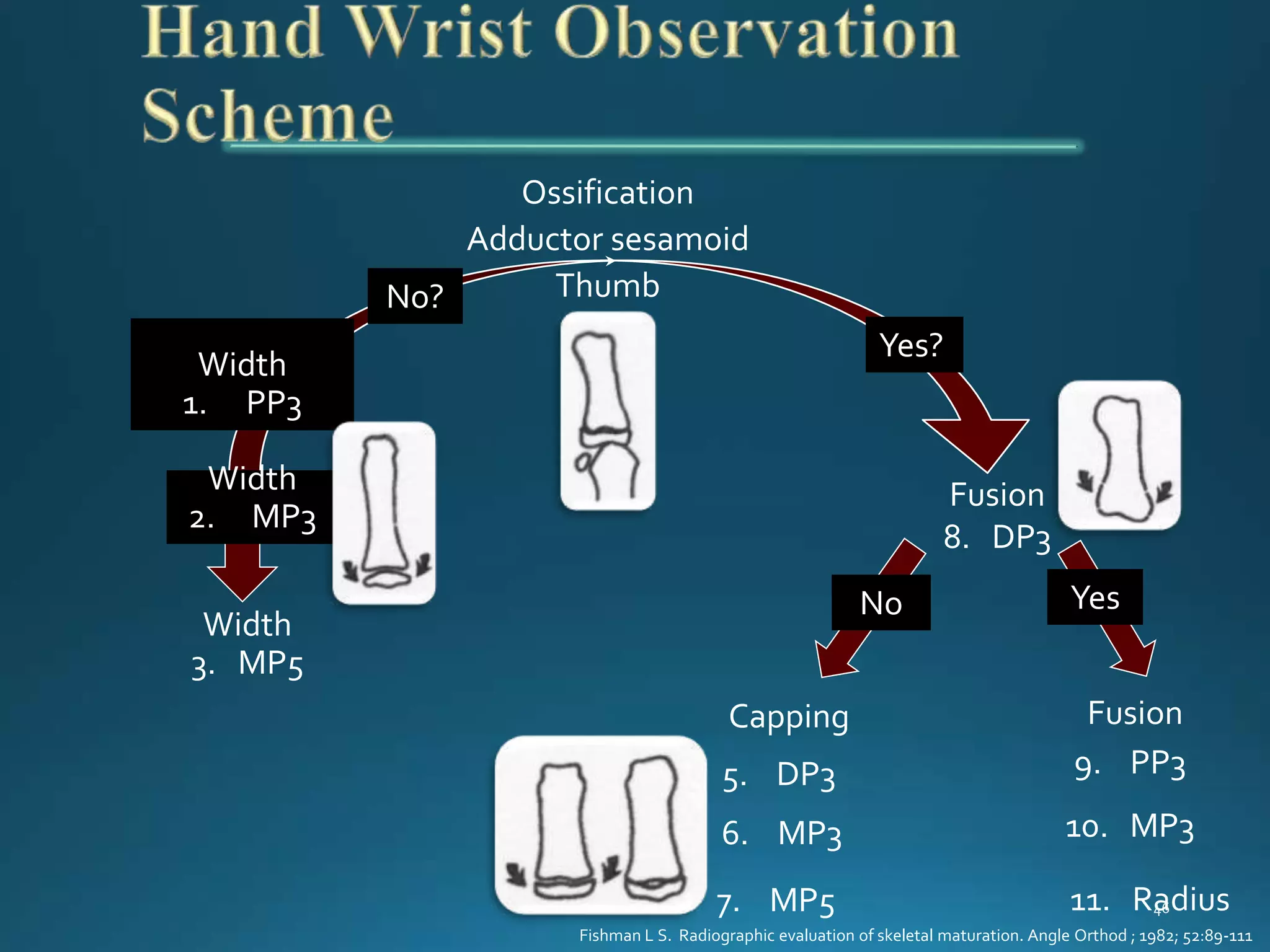 Hand Wrist Radiography | PPTX