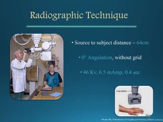 64cm
• 0° Angulation
• 46 Kv, 6.5 mAmp, 0.4 sec
Phulari BS, Orthodontics Principles and Practice, Edition 1;205-15
 