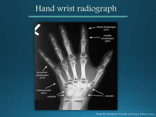 Hand wrist radiograph
Phulari BS, Orthodontics Principles and Practice, Edition 1;205-15
 