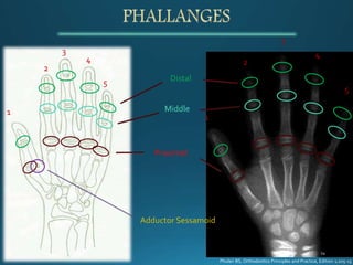 1
3
2
4
5
1
3
2
4
5
Proximal
Middle
Distal
Adductor Sessamoid
Phulari BS, Orthodontics Principles and Practice, Edition 1;205-15
 