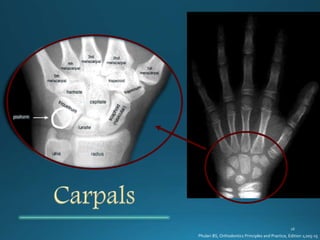 Phulari BS, Orthodontics Principles and Practice, Edition 1;205-15
 