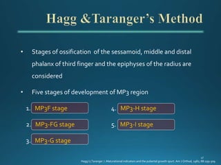 • Stages of ossification of the sessamoid, middle and distal
phalanx of third finger and the epiphyses of the radius are
considered
• Five stages of development of MP3 region
1. MP3F stage 4. MP3-H stage
2. MP3-FG stage 5. MP3-I stage
3. MP3-G stage
Hagg U,Taranger J .Maturational indicators and the pubertal growth spurt. Am J Orthod, 1982; 88:299-309.
 