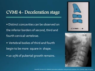 CVMI 4- Deceleration stage
• Distinct concavities can be observed on
the inferior borders of second, third and
fourth cervical vertebrae.
• Vertebral bodies of third and fourth
begin to be more square in shape.
• 10-25% of pubertal growth remains.
Hassel B, Farman A G. Skeletal maturation evaluation using cervical vertebrae. Am J Orthod, 1995; 107:58-61
 