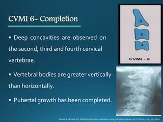 CVMI 6- Completion
• Deep concavities are observed on
the second, third and fourth cervical
vertebrae.
• Vertebral bodies are greater vertically
than horizontally.
• Pubertal growth has been completed.
Hassel B, Farman A G. Skeletal maturation evaluation using cervical vertebrae. Am J Orthod, 1995; 107:58-61
 