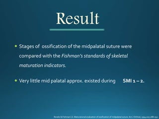 Result
 Stages of ossification of the midpalatal suture were
compared with the Fishman’s standards of skeletal
maturation indicators.
 Very little mid palatal approx. existed during SMI 1 – 2.
Revelo B,Fishman LS. Maturational evaluation of ossification of midpalatal suture. Am J Orthod, 1994;105:288-292
 