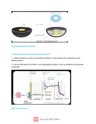 MDDS -MODULATED DRUG DELIVERY SYSTEM | PDF