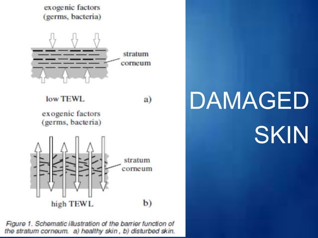 Functions of skin & Trans-epidermal water loss | PPTX | Skin and ...