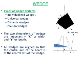 Wedge System Example Seminar 2 .beam modification devices | PPT