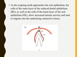 • As the erupting tooth approaches the oral epithelium, the
cells of the outer layer of the reduced dental epithelium
(RE), as well as the cells of the basal layer of the oral
epithelium (OE), show increased mitotic activity and start
to migrate into the underlying connective tissue..
 
