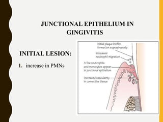 JUNCTIONAL EPITHELIUM IN
GINGIVITIS
INITIAL LESION:
1. increase in PMNs
 
