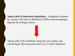 Apical shift of junctional epithelium: collagenase released
by various cells such as fibroblasts, PMNs and macrophages
degrade the collegen matrix.
Apical cells of JE proliferate along the root surface and
extend finger like projections that are 2-3 cell in thickness.
 