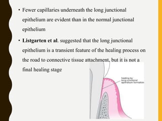 • Fewer capillaries underneath the long junctional
epithelium are evident than in the normal junctional
epithelium
• Listgarten et al. suggested that the long junctional
epithelium is a transient feature of the healing process on
the road to connective tissue attachment, but it is not a
final healing stage
 
