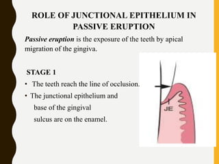 ROLE OF JUNCTIONAL EPITHELIUM IN
PASSIVE ERUPTION
Passive eruption is the exposure of the teeth by apical
migration of the gingiva.
STAGE 1
• The teeth reach the line of occlusion.
• The junctional epithelium and
base of the gingival
sulcus are on the enamel.
 