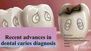 Recent advances in
dental caries diagnosis
Dr. Gousalya,
1st year post graduate student,
Department of Public Health Dentistry,
SRMDC,
31/5/2021
 