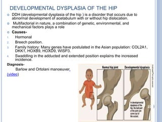 Genetic Dislocation Differential diagnosis of hip | PPTX