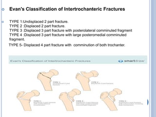Differential diagnosis of hip | PPTX