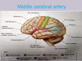 Middle cerebral artery
 
