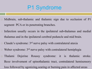 P1 Syndrome
 Midbrain, sub-thalamic and thalamic sign due to occlusion of P1
segment PCA or its penetrating branches.
 Infarction usually occurs in the ipsilateral sub-thalamus and medial
thalamus and in the ipsilateral cerebral peduncle and mid brain.
 Claude’s syndrome: 3rd nerve palsy with contralateral ataxia
 Weber syndrome: 3rd nerve palsy with contralateral hemiplegia
 Thalami Dejerine Roussy syndrome: it is thalamic stroke.
Bcoz involvement of spinothalamic tract, contralateral hemisensory
loss followed by agonizing,searing or burning pain in affected areas
 