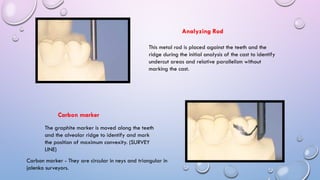 SURVEYING IN THE REMOVABLE PARTIAL DENTURES | PPTX