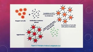 antigen and antibody reactions- Immunology | PPTX