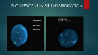 FLOURESCENT IN-SITU HYBRIDISATION
 