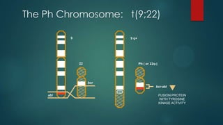 The Ph Chromosome: t(9;22)
22
bcr
abl
Ph ( or 22q-)
bcr-abl
FUSION PROTEIN
WITH TYROSINE
KINASE ACTIVITY
9 9 q+
 