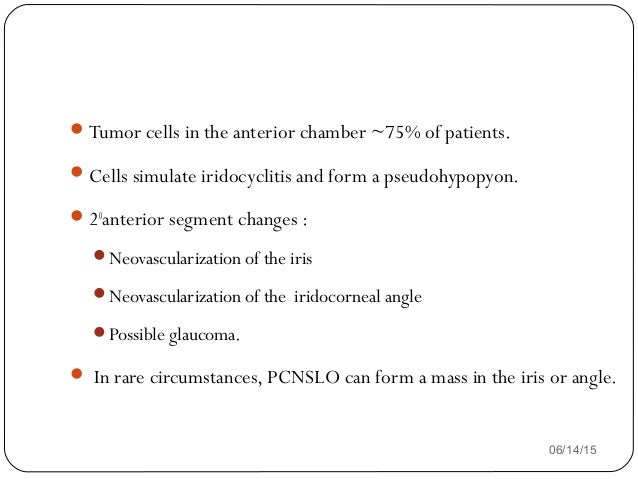 Ocular Lymphoma - 