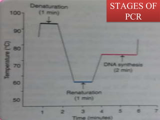 STAGES OF
PCR
 