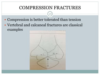 COMPRESSION FRACTURES
 Compression is better tolerated than tension
 Vertebral and calcaneal fractures are classical
examples
40
 