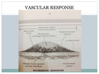 VASCULAR RESPONSE
46
 
