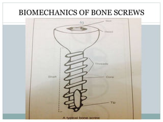 BIOMECHANICS OF BONE SCREWS
63
 