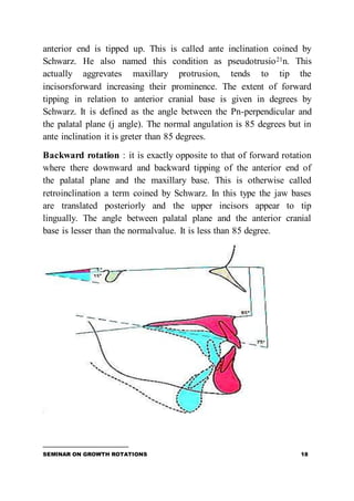 Inclination Rotation Angulation Growth rotations | DOCX