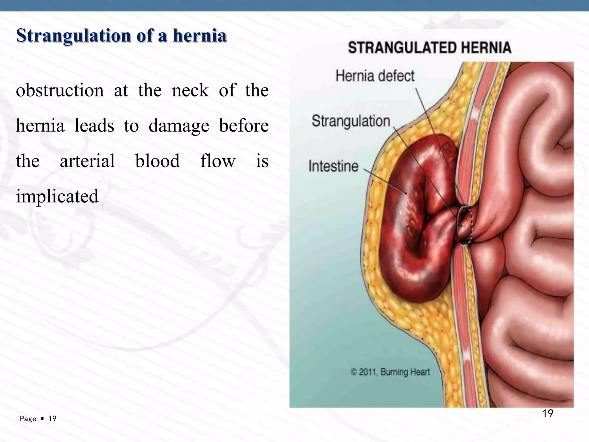 Ischemia and Infarction | PPTX