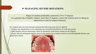 Button For Rotation Invisalign Comprehensive Guide on the Role of Attachments in Clear Aligners for ...