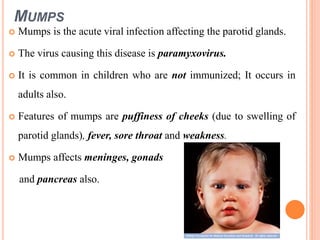 saliva in oral health | PPTX