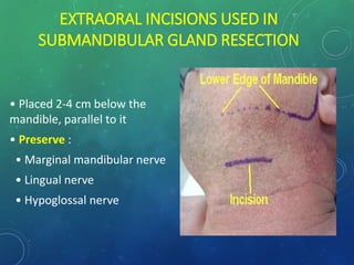 Sublabial Excision Surgical Anatomy of Salivary Glands and its Applied aspects | PPTX