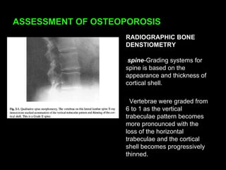 ASSESSMENT OF OSTEOPOROSIS
RADIOGRAPHIC BONE
DENSTIOMETRY
spine-Grading systems for
spine is based on the
appearance and thickness of
cortical shell.
Vertebrae were graded from
6 to 1 as the vertical
trabeculae pattern becomes
more pronounced with the
loss of the horizontal
trabeculae and the cortical
shell becomes progressively
thinned.
 