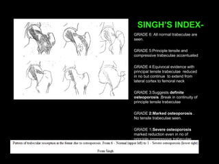 SINGH’S INDEX-
GRADE 6: All normal trabeculae are
seen.
GRADE 5:Principle tensile and
compressive trabeculae accentuated
GRADE 4:Equivocal evidence with
principal tensile trabeculae reduced
in no but continue to extend from
lateral cortex to femoral neck
GRADE 3:Suggests definite
osteoporosis .Break in continuity of
principle tensile trabeculae
GRADE 2:Marked osteoporosis .
No tensile trabeculae seen.
GRADE 1:Severe osteoporosis
marked reduction even in no of
principle compressive trabeculae
 